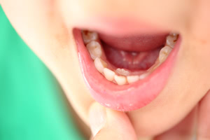 乳歯から永久歯への生え変わり時期