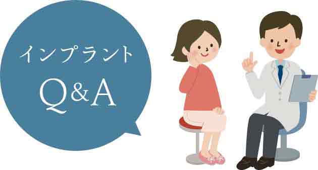 インプラントQ&A