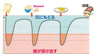 虫歯になりにくい生活習慣のイメージ