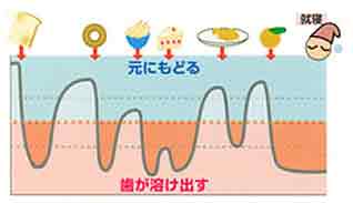 虫歯になりやすい生活習慣のイメージ