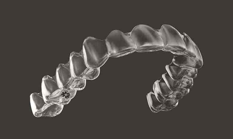 マウスピース型矯正装置（インビザライン®） イメージ