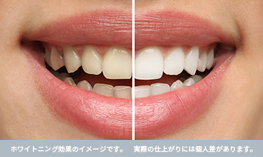 効果が持続しやすい