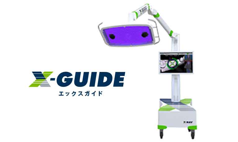これまでのインプラント手術とどう違う?